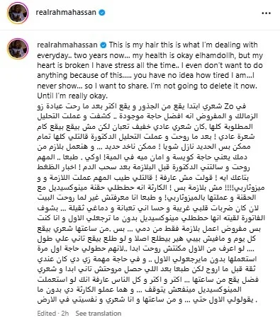 بالصور| تفاصيل إصابة الفنانة رحمة حسن بالصلع وتساقط شعرها بسبب التوتر النفسي 
